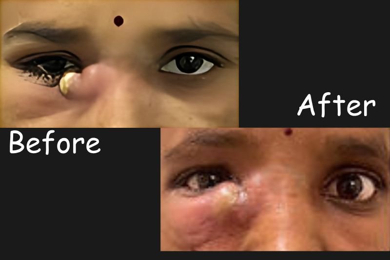 Dacryology