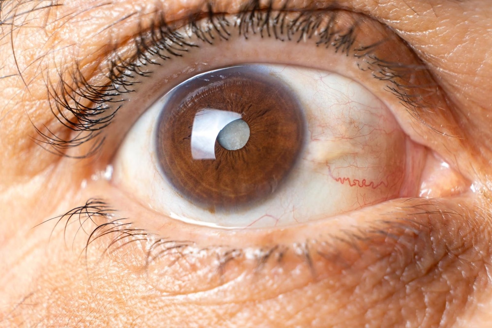 Best glaucoma doctor in Nagpur