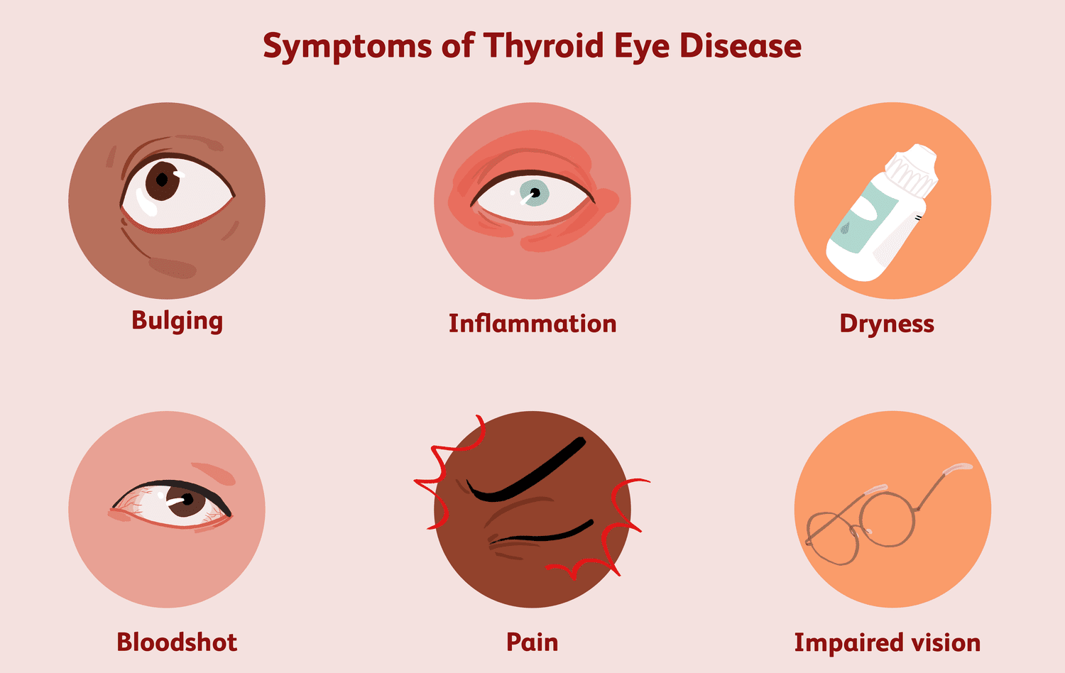 Thyroid eye disease treatment in Nagpur
