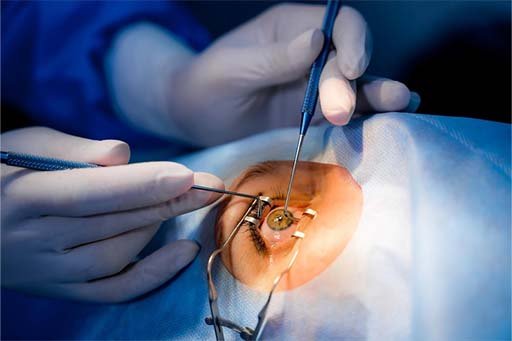 Cataract eye hospital in Nagpur