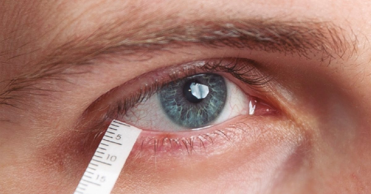 Dry eye screening in Nagpur