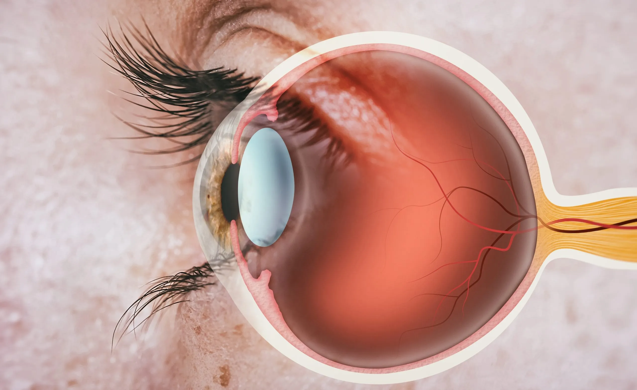Retina treatment in Nagpur